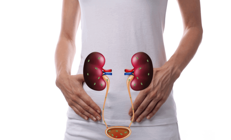 What are UTIs?
